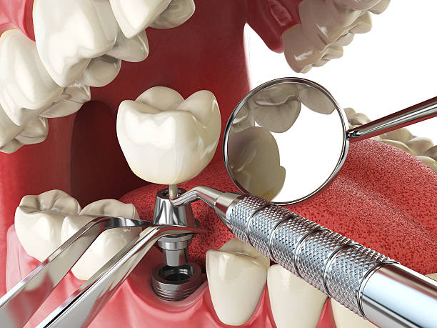 Best After-Hours Emergency Dentist in Linganore, MD